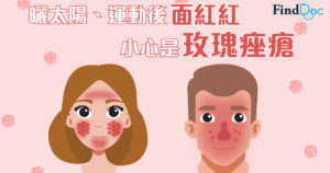 玫瑰痤瘡