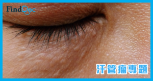 眼睛下面有一粒粒是甚麼?