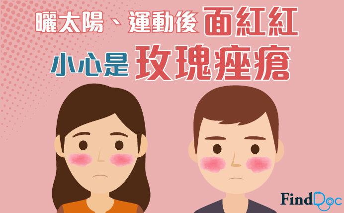 玫瑰痤瘡
