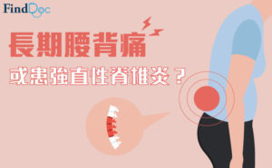 強直性脊椎炎