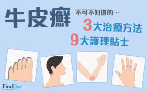 牛皮癬