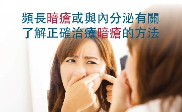 頻長暗瘡或與內分泌有關 了解正確治療暗瘡的方法