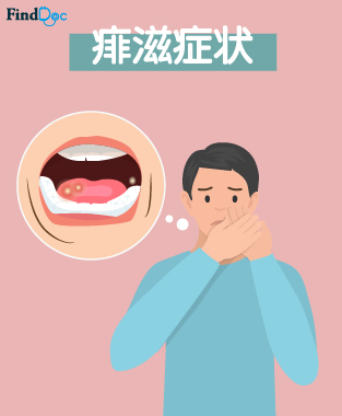 生痱滋,是热气,压力大引致?痱滋的7个舒缓方法及5类治疗药物