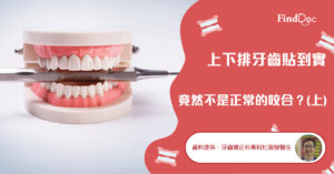 上下排牙齒貼到實 竟然不是正常的咬合?(上)
