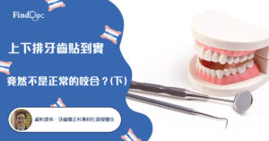 上下排牙齒貼到實 竟然不是正常的咬合?(下)