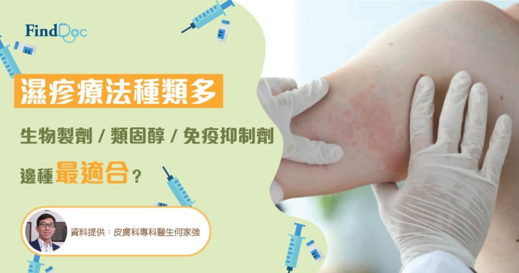濕疹療法種類多 生物製劑 vs 類固醇 vs 免疫抑制劑 邊種最適合?