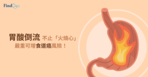 胃酸倒流不止「火燒心」 嚴重可增食道癌風險