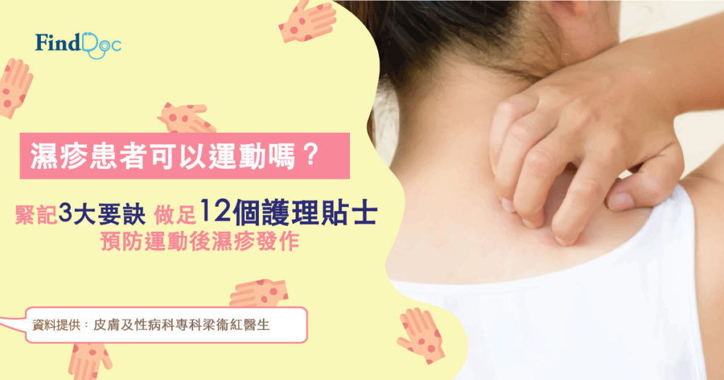 濕疹患者可以運動嗎?緊記3大要訣 做足12個護理貼士 預防運動後濕疹發作